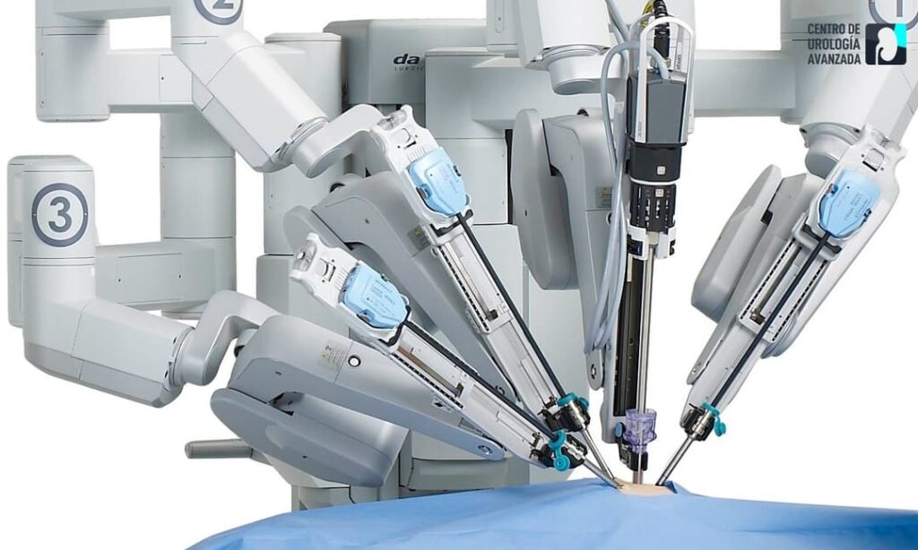 Cirurgia robótica da próstata